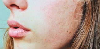 8 motive pentru care tenul tău este îmbătrânit si lipsit de strălucire