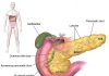 Cancerul de pancreas, a cincea cauză de deces din lume – Află cum se poate preveni