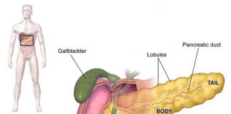 Cancerul de pancreas, a cincea cauză de deces din lume – Află cum se poate preveni