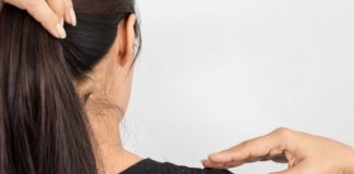 Ai mătreață? Folosește aceste două amestecuri simple și la îndemâna oricui