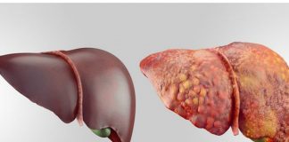 Acest FRUCT IEFTIN detoxifică ficatul! Fă-ți analizele după o cură și vei vedea rezultatul miraculos!