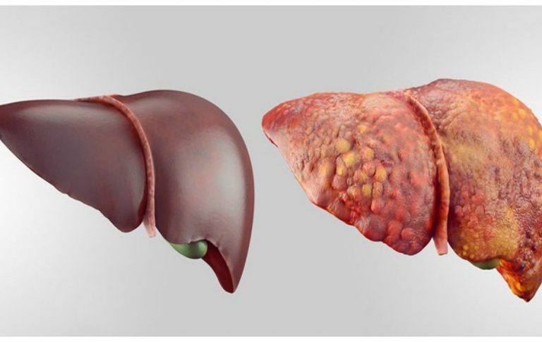 Acest FRUCT IEFTIN detoxifică ficatul! Fă-ți analizele după o cură și vei vedea rezultatul miraculos!