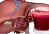 Sucul din sfeclă roșie benefic pentru detoxifierea ficatului