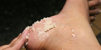 Cum tratăm călcâiele crăpate fără chimicale