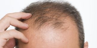 6 alimente care pot combate pierderea părului