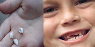Nu mai aruncați dinții de lapte ai copiilor! Sunt foarte valoroși