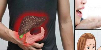 Semne care arată că ficatul tău este plin de toxine