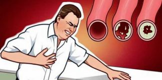 10 alimente care îți vor curăța arterele în mod natural și care te pot proteja de atacuri de cord