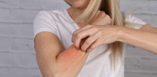 Cinci moduri dovedite de a ameliora mâncărimea de la mușcăturile de tânțari