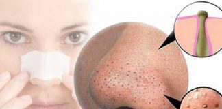 Cele mai eficiente moduri de a scapa de punctele negre de pe nas