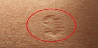 Știi care e semnificația cicatricei rotunde în partea de sus a brațelor?