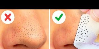 Cele mai eficiente moduri de a scapa de punctele negre de pe nas