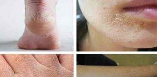 Bolile din corp se pot citi pe fata si pe piele. Semnele la care trebuie sa fii atent