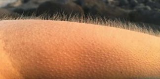 8 mecanisme de aparare ale corpului