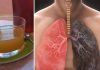 Cum se prepară un sirop natural care curăță plămânii și îi întărește