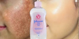 Cum să vă ușurați și să vă îndepărtați petele, ridurile și melasmele…