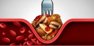 10 moduri eficiente pentru scaderea colesterolului LDL