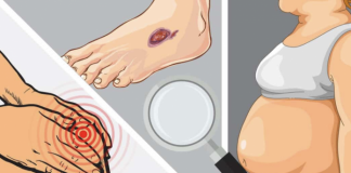 9 semne ale deficitului de proteine – cum se remediază