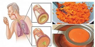 Sirop de tuse, făcut în casă – Ajută la îndepărtarea flegmei din plămâni într-o singură noapte