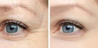 Datorită acestor 4 uleiuri, ridurile din jurul ochilor sunt netezite: doar încercați!