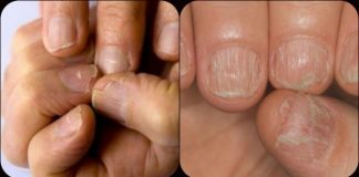 5 efecte negative ale manichiurii cu gel