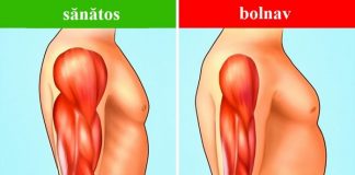 Afecțiuni ale sistemului muscular