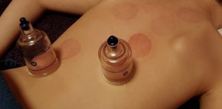 TERAPIA CU VENTUZE – Leacul bunicilor noștri pentru multiple probleme ale sănătății