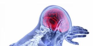 6 semne ale Accidentului Vascular Cerebral (AVC) pe care oamenii întotdeauna le ignoră – factori de risc și prevenție!