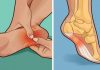 10 remedii la îndemâna oricui împotriva Durerilor de Picioare – Călcâie, Genunchi sau de Șold