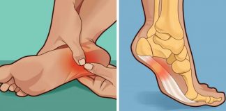 10 remedii la îndemâna oricui împotriva Durerilor de Picioare – Călcâie, Genunchi sau de Șold