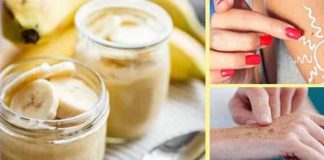 Alunițe, negi, papiloame sau pete maronii? Iată câteva remedii naturale care vă pot ajuta să le eliminați!