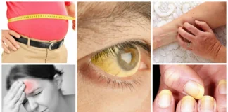 Primele semne care îți arată că ai PROBLEME cu FICATUL!