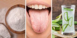 Limbă albă (încărcată) – cauze și 7 remedii naturiste!