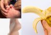 Călcâie crăpate, tălpi uscate – patru soluții geniale de făcut acasă. Trebuie să încerci remediul cu banane!