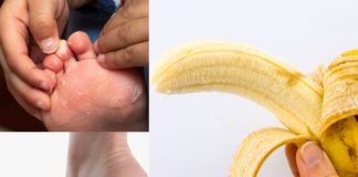 Călcâie crăpate, tălpi uscate – patru soluții geniale de făcut acasă. Trebuie să încerci remediul cu banane!