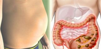 Nu ești gras, ești doar balonat! – Încearcă rețeta care te scapă imediat de toxine și balonare.