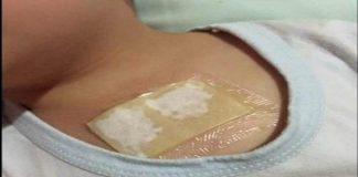 Comprese cu ghimbir – Elimină mucusul din plămâni într-o singură noapte și vindecă tusea!