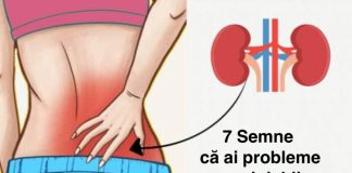 Dacă rinichii suferă, corpul prezintă aceste 7 semnale de alarmă!