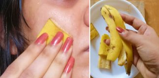 Coaja de banană – remediu extern pentru coșuri și alte 5 întrebuințări despre care cu siguranță nu știați!