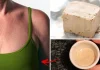 Cum să scapi de ridurile de pe piept și gât cu drojdia de bere