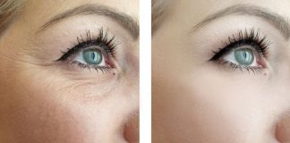 Datorită acestor 4 uleiuri, ridurile din jurul ochilor sunt netezite: doar încercați!