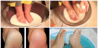 Tratament pentru călcâie aspre și crăpate – Picioarele vor fi mai netede în numai 10 minute!