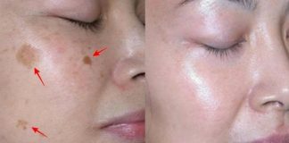 Cum poți scăpa de riduri și de petele de pe față, folosind ulei de cocos și bicarbonat!