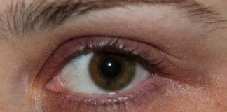 Preparatul eficient care îți elimină cercurile întunecate din jurul ochilor