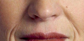 Află cum poți estompa ridurile din jurul gurii cu tratamente naturale