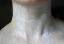 Fă asta, iar gâtul tău se va opri din a-ți mai arăta vârsta.Te vei simți cu 10 ani mai tânără!