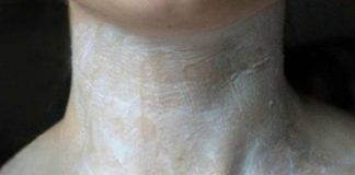 Fă asta, iar gâtul tău se va opri din a-ți mai arăta vârsta.Te vei simți cu 10 ani mai tânără!